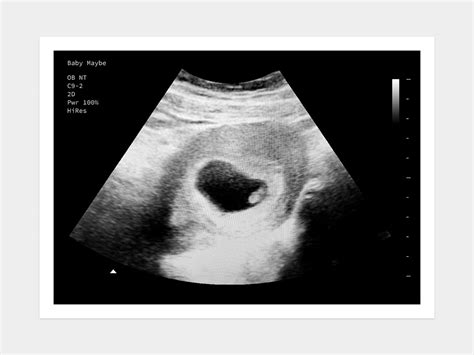 dating ultrasound 6 weeks